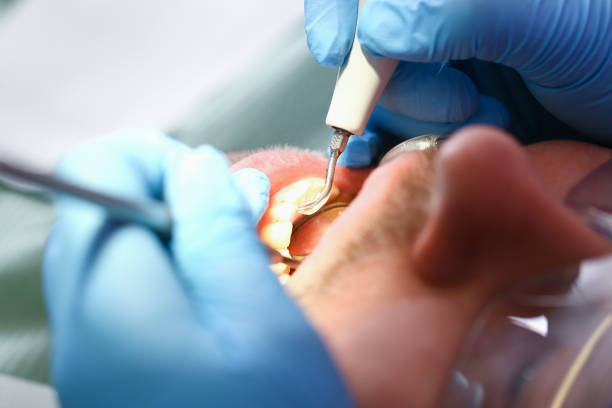 Best Emergency Broken Tooth Repair in Lacy Lakeview, TX