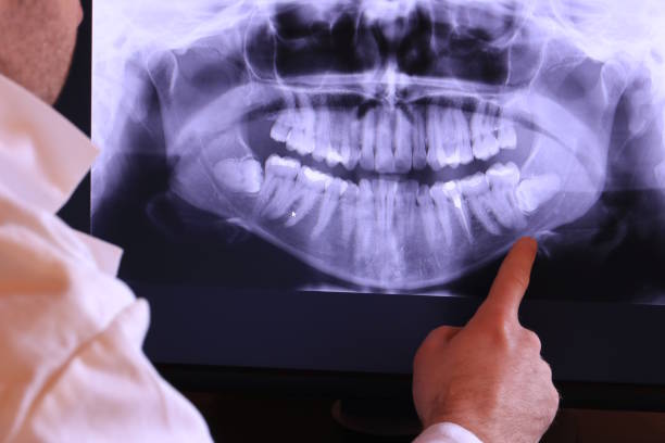 Best 24-Hour Emergency Dentist in Lacy Lakeview, TX
