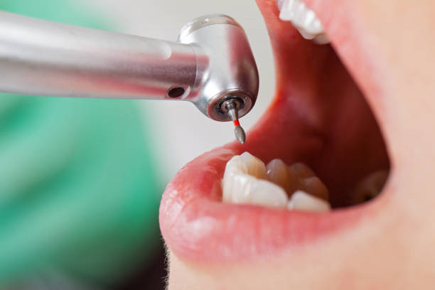 Best Emergency Treatment for Toothache in Lacy Lakeview, TX